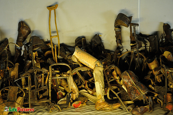 Prosthesis